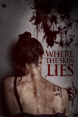 Where the Skin Lies Where the Skin Lies