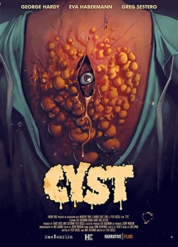 Cyst Cyst